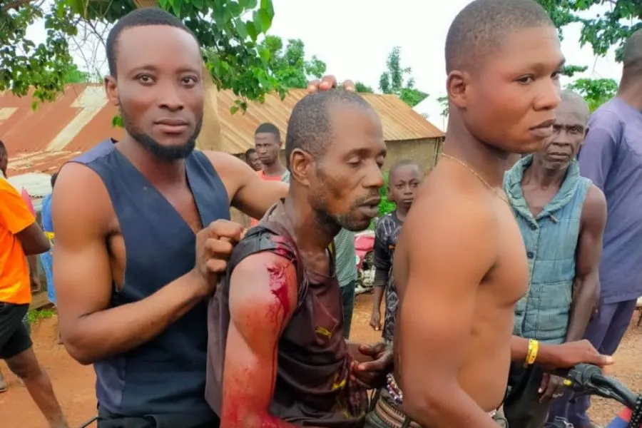 Un jeune homme abattu le mois dernier par des bergers peuls dans le village d'Ukhol, dans l'État de Benue, est transporté à l'hôpital. Crédit photo : Fr Jacob Igah